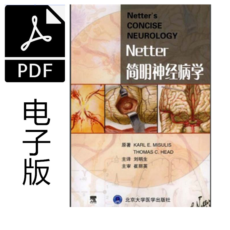 《奈特简明神经病学》刘明生 主译.PDF电子书下载