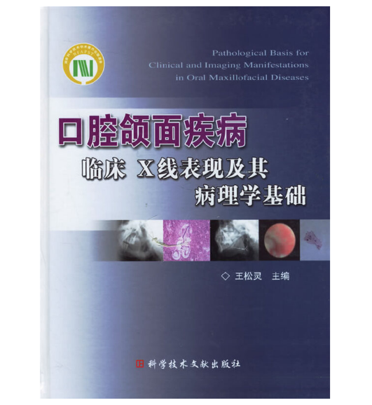 《口腔颌面疾病临床X线表现及其病理学基础》王松灵(主编)PDF电子书下载