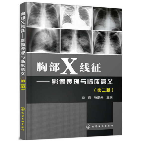 《胸部X线征 影像表现与临床意义》第2版_李羲主编.PDF电子书下载
