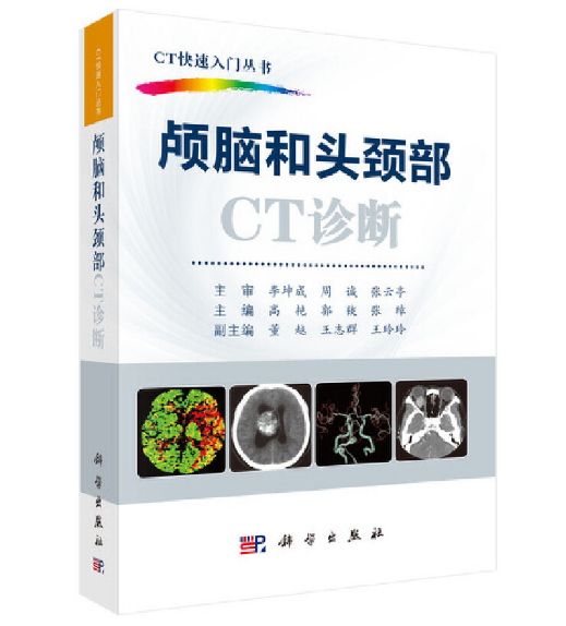 图片[2]-《CT快速入门丛书：颅脑和头颈部CT诊断》高艳主编.PDF电子书下载