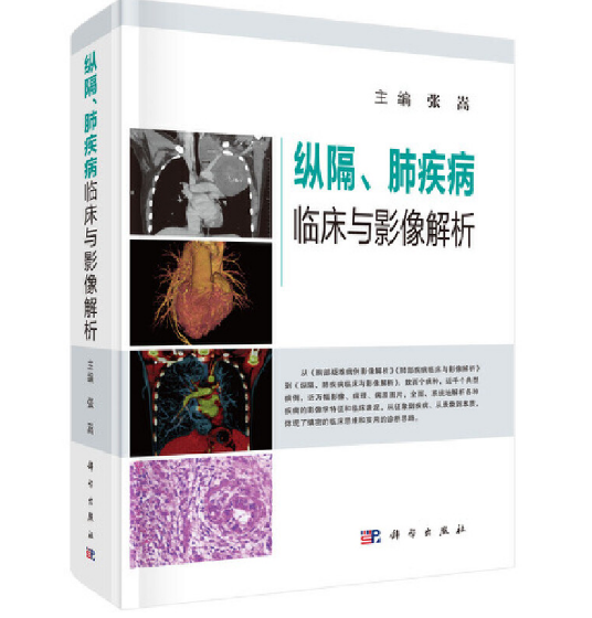 图片[2]-《纵隔、肺疾病临床与影像解析》张嵩主编.PDF电子书下载