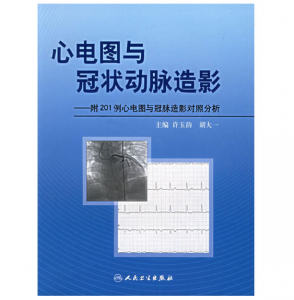 心电图与冠状动脉造影（高清版）PDF电子书下载-小燕电子书