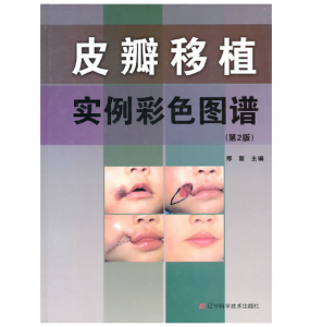 皮瓣移植实例彩色图谱（第2版）邢新主编.PDF电子书下载-小燕电子书