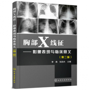 《胸部X线征 影像表现与临床意义》第2版_李羲主编.PDF电子书下载-小燕电子书